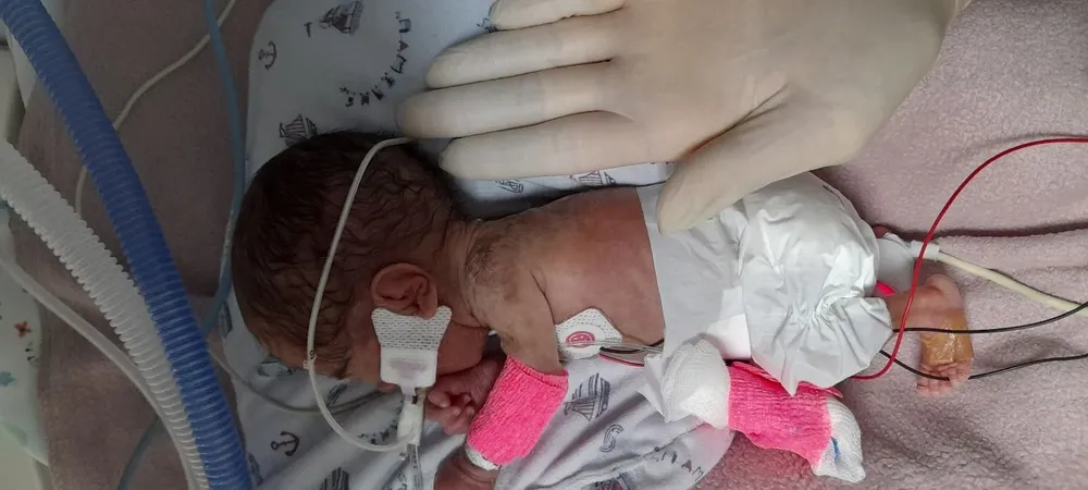 Cuando nació, el 18 de marzo, cabía en la palma de las enfermeras.