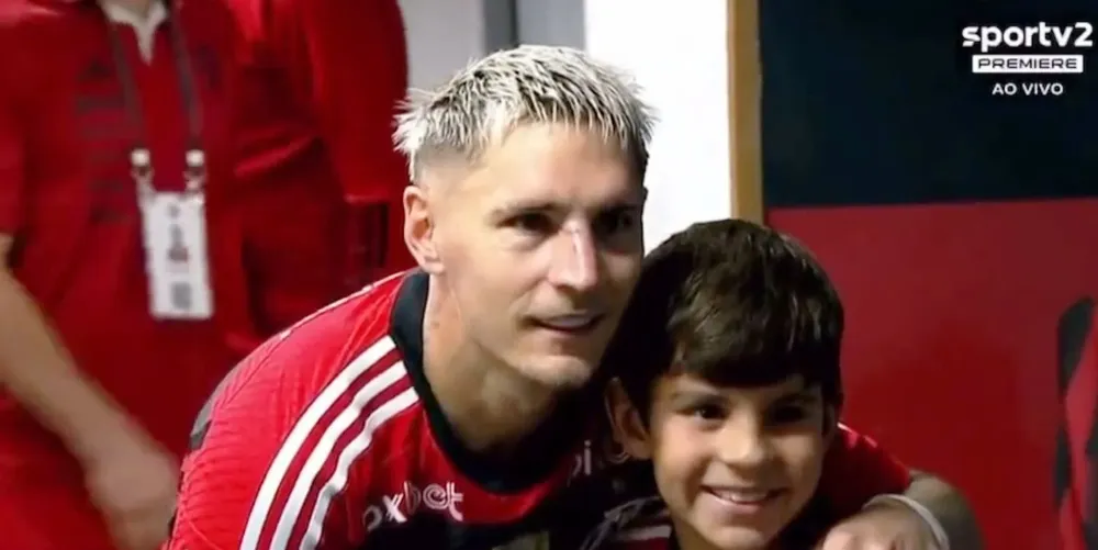 Así quedó el rostro de Guillermo Varela