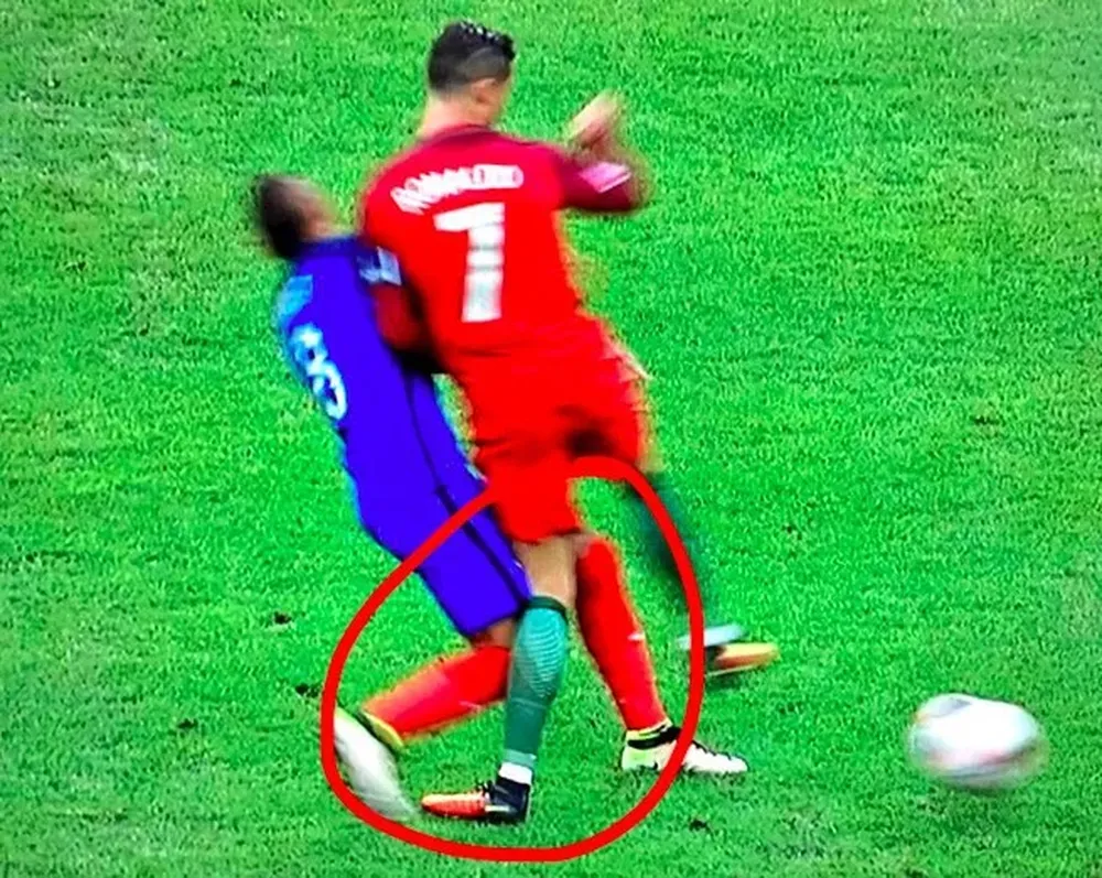 Así se dobló el tobillo de CR7