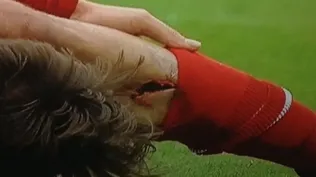 La escalofriante lesión de Gastón Ramírez