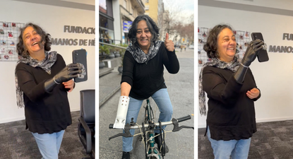 perdio su mano en un accidente pero nunca su fuerza por salir adelante: una nueva historia de manos de heroes