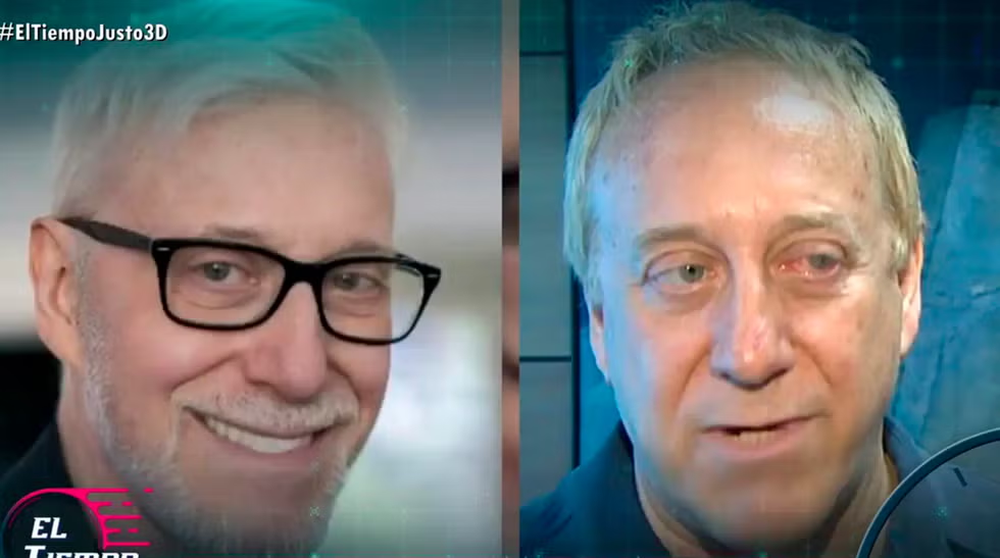 Josep Mainat, antes y después del tratamiento de retroenvejecimiento.