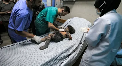 Un niño es atendido en un hospital de Gaza