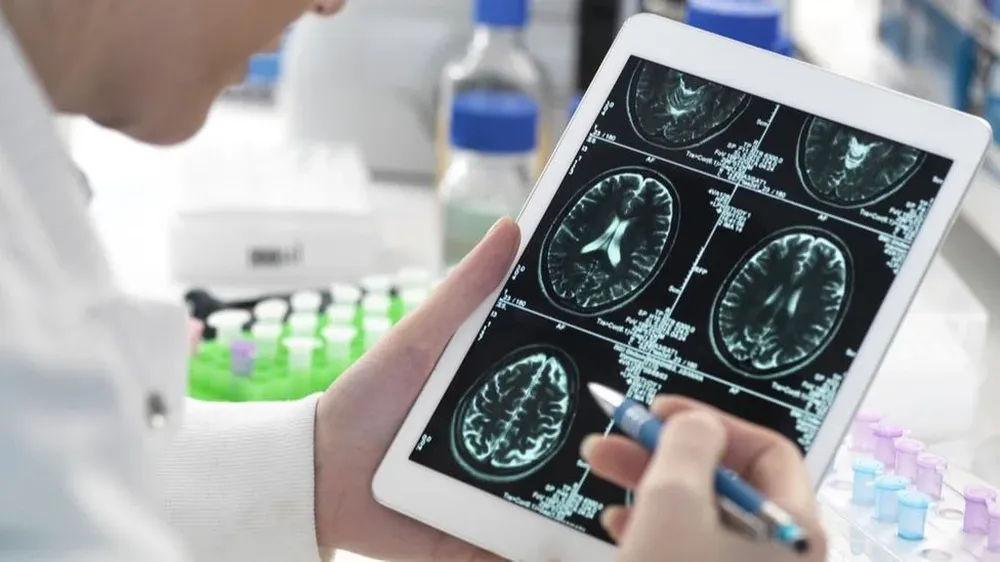 Estudios científicos han demostrado cambios en el cerebro en pacientes que han tenido covid-19.