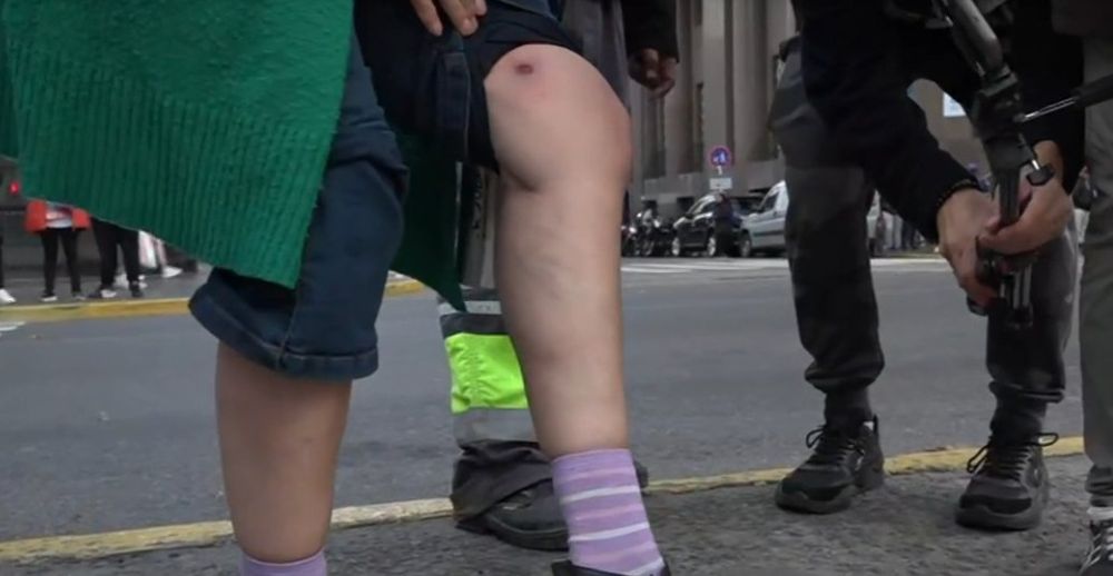 Romina del Plá, denunció esta tarde haber sido víctima de un ataque con balas de goma por parte de la Policía en el Congreso﻿