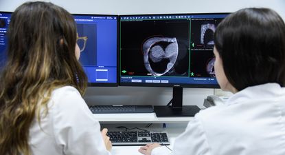 nueva tecnologia de radioterapia acorta francamente los tiempos de tratamiento
