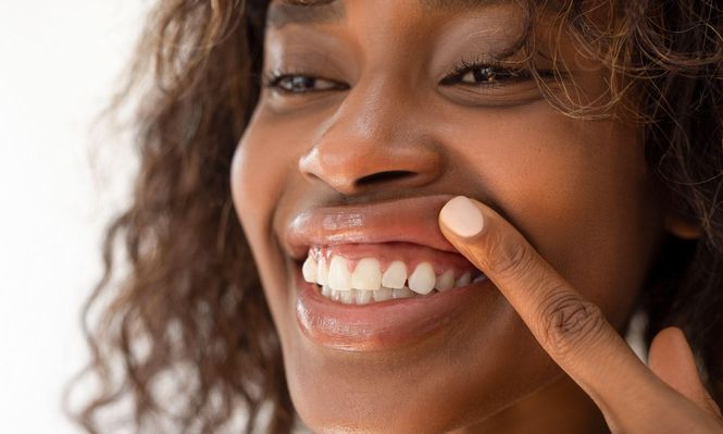 Qué puede provocar que tus encías se retraigan (y qué puedes hacer para evitarlo)