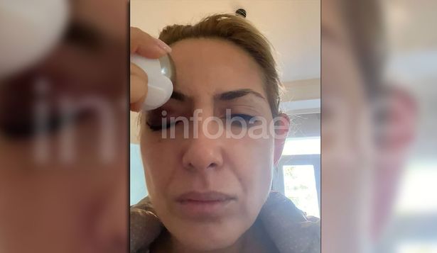 Un video y una foto de un moretón en el ojo, las nuevas pruebas que presentó Yañez para respaldar su denuncia contra Alberto Fernández