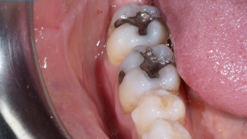 amalgamadental