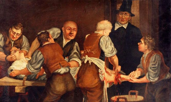 La cirugía no era una cuestión de precisión delicada, sino cruda, sangrienta, a menudo caótica... y antihigiénica.