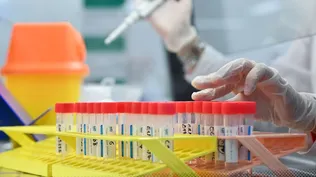 Estudio muestra que niveles de anticuerpos se mantienen 9 meses después de haber contraído la enfermedad