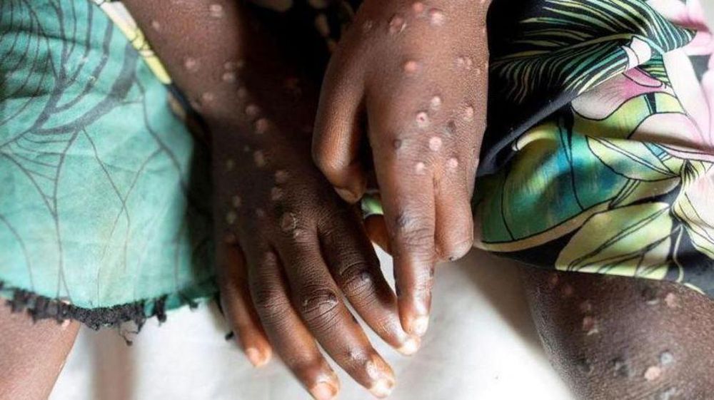 https://www.bbc.com/mundo/articles/c3ejzznkd8jo
