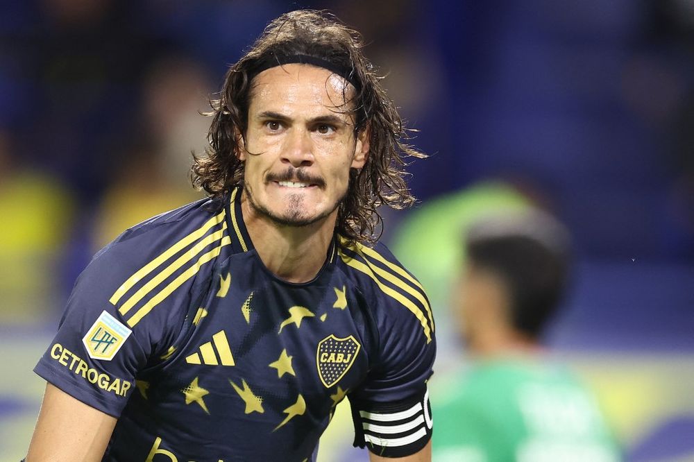 Edinson Cavani se pierde el Superclásico. Edinson Cavani se pierde el Superclásico.
