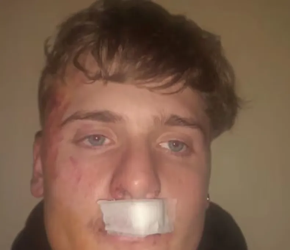 Joven de 19 años, victima del brutal ataque de rugbiers en una fiesta de Zárate