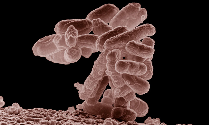 Europa en alerta por la presencia de Escherichia coli en queso de Francia.