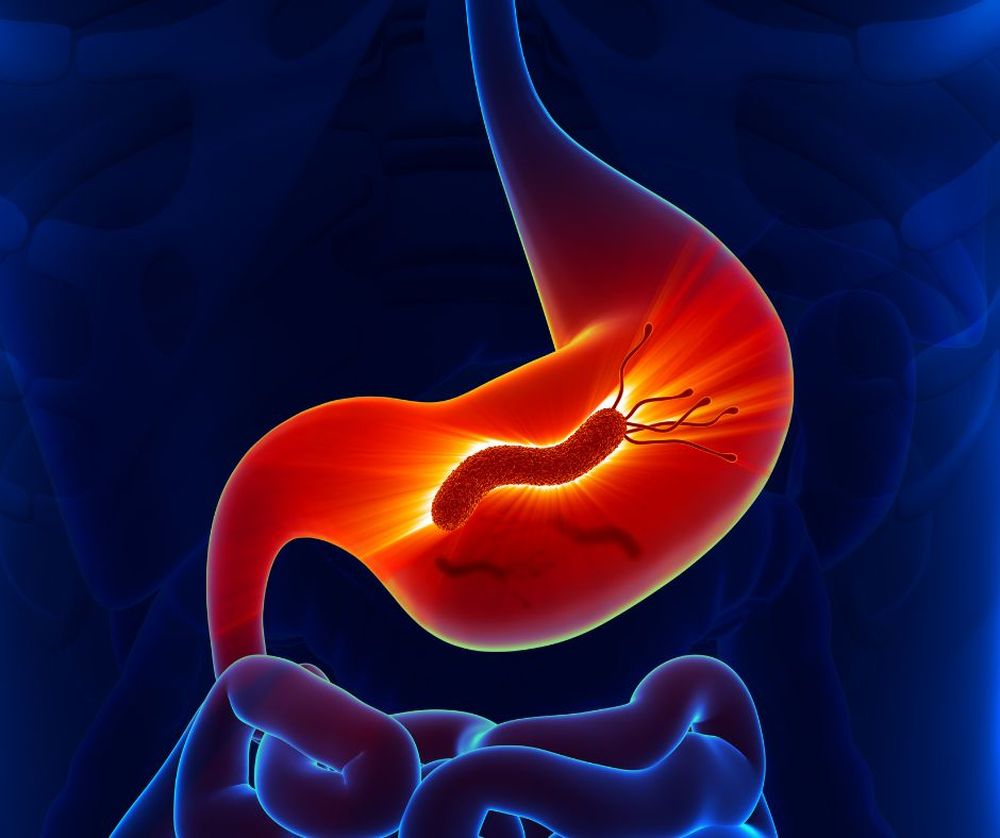 La bacteria Helicobacter pylori