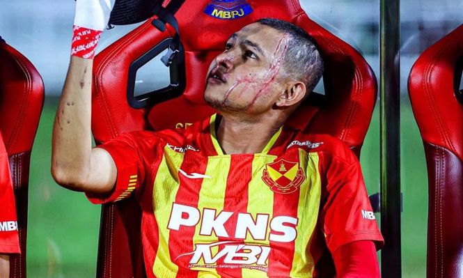 ¡Escalofriante! Futbolista fue rociado con ácido, sufrió quemaduras en todo el cuerpo y volvió a la selección de su país