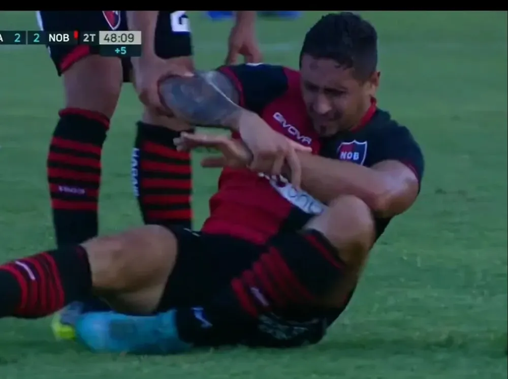 La fractura de Armando Méndez