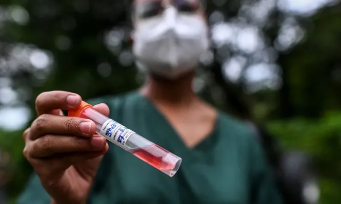 Hay 29 contagios de coronavirus y nuevo récord de casos activos