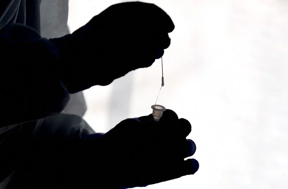 El comunicado del Sinae también dio cuenta que este sábado fallecieron nueve personas a causa de esta infección