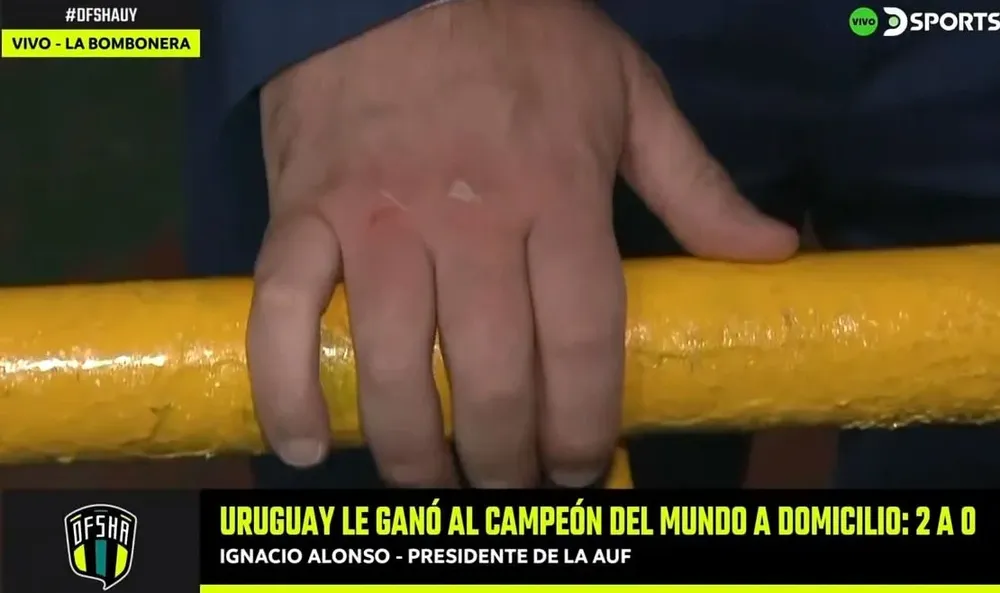 Así le quedaron los nudillos al presidente de la AUF