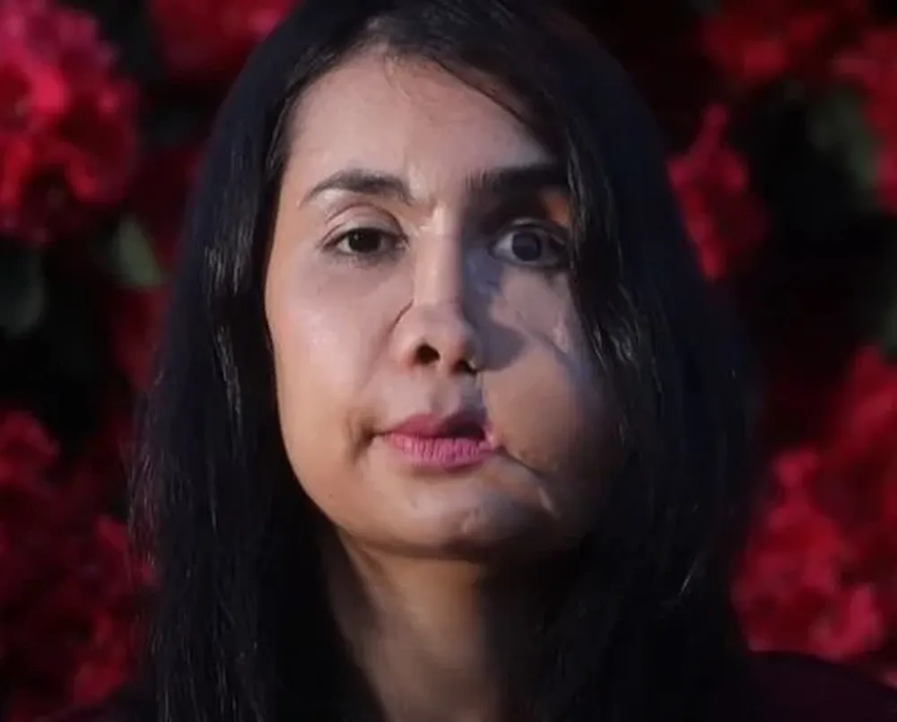 Con 17 años, fue obligada a casarse con un hombre mayor que ella