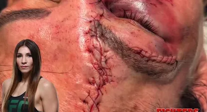 El impactante corte que sufrió una luchadora de MMA Irene Aldana