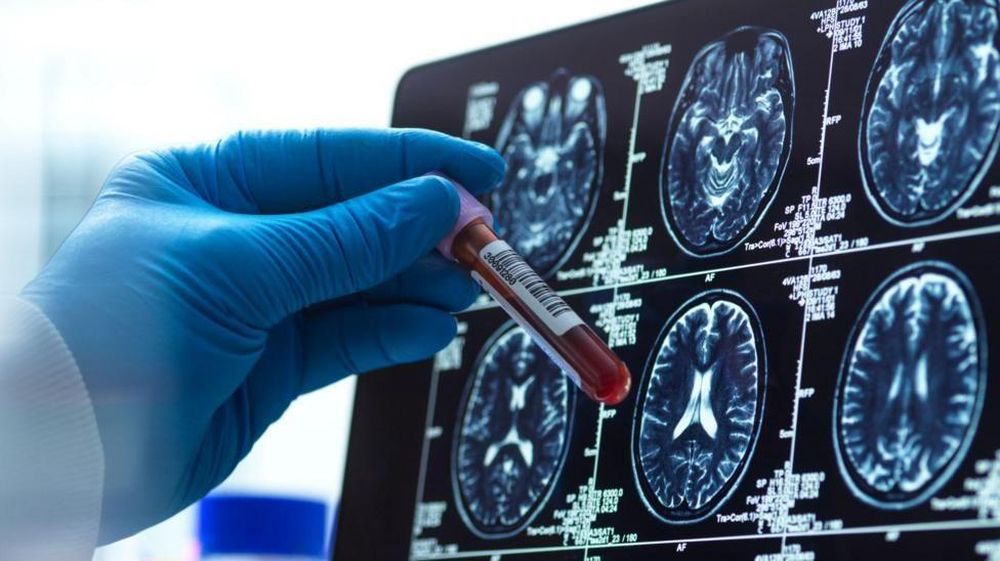 https://www.bbc.com/mundo/articles/c99718dpepro