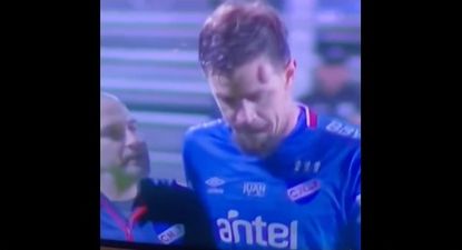 Sebastián Coates se fue del Parque Viera con un enorme chichón en la cabeza tras un cabezazo en el Danubio-Nacional