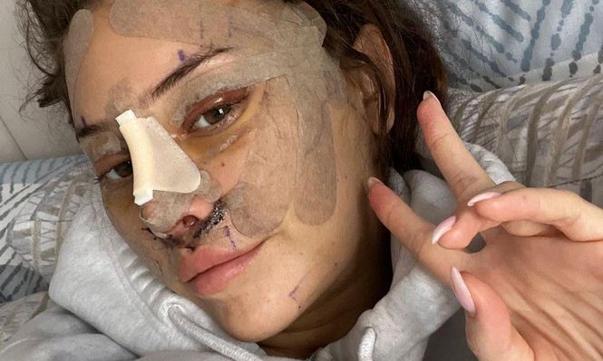 La joven Emily compartió fotos tras someterse a cirugía estética.