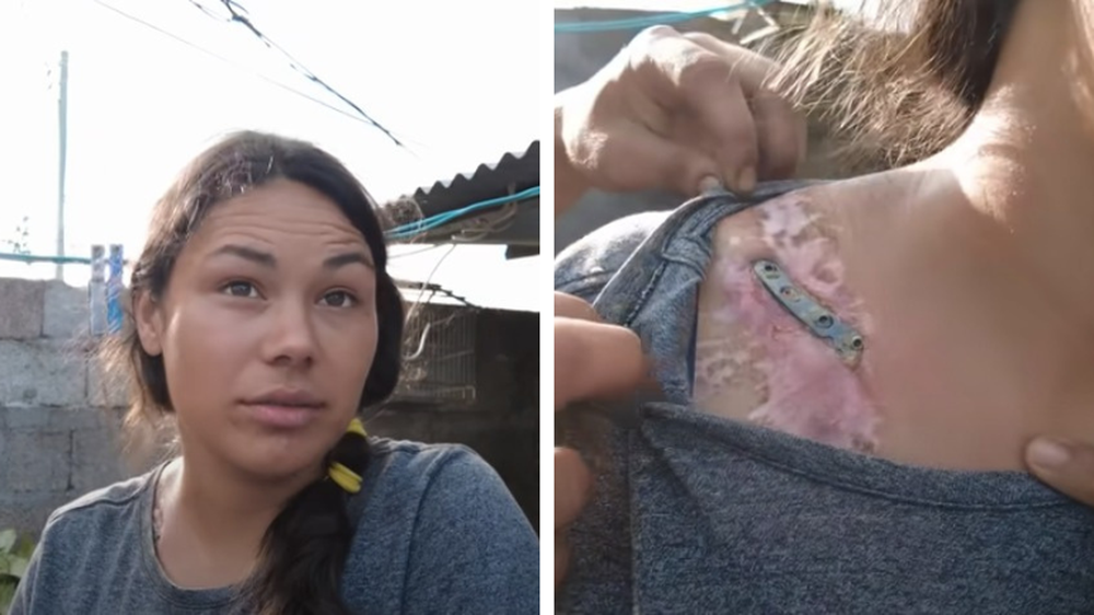 Joven reclama desatención por parte de ASSE