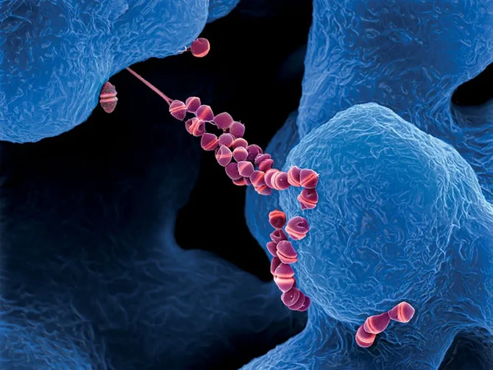 Lo necesario es un tratamiento oportuno para evitar mayores complicaciones