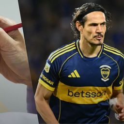 que es un bloqueo lumbar, el tratamiento al que se sometera edinson cavani para volver a jugar en boca que es un bloqueo lumbar, el tratamiento al que se sometera edinson cavani para volver a jugar en boca