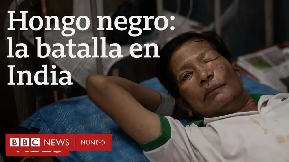 Deslizá hacia abajo para reproducir el video