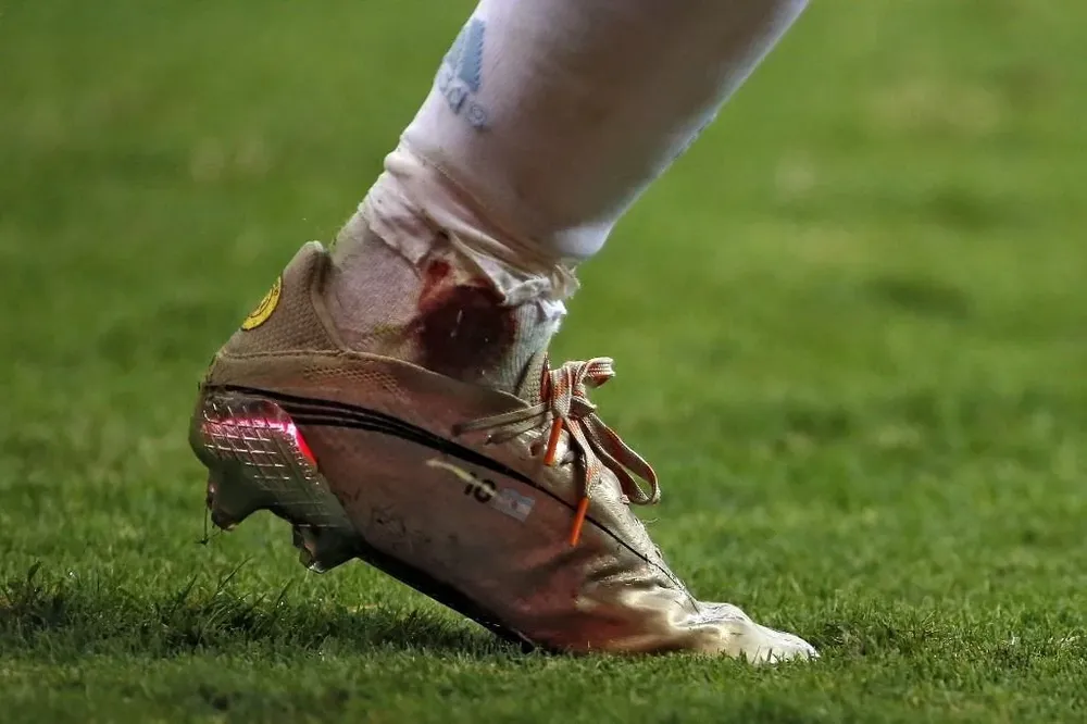 Así quedó el tobillo de Messi