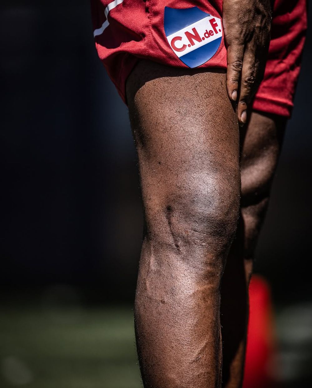Las impactantes fotos de la recuperación de Gonzalo Carneiro Las impactantes fotos de la recuperación de Gonzalo Carneiro