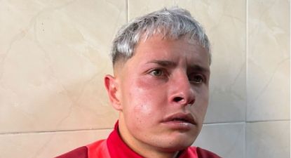 Jean Martínez, el futbolista de Rentistas que fue agredido en su rostro por un policía tras el partido ante Cerrito por la Segunda división profesional