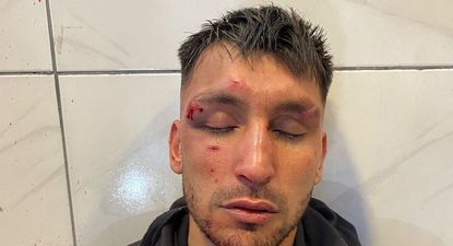 Así quedó Lucas Suárez