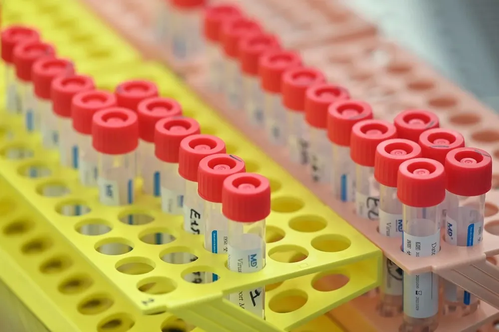 El Sinae actualizó los datos de pacientes con coronavirus