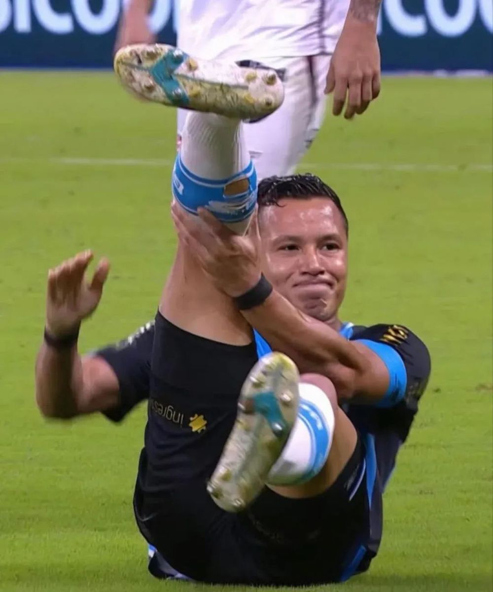 La impactante lesión que sufrió Marlon, jugador de Gremio