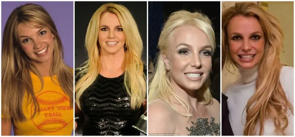 Britney Spears y los cambios que experimentó su rostro.