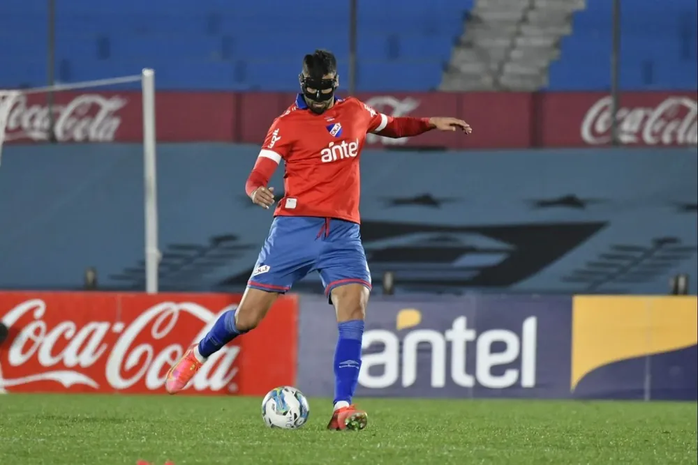 Mario Risso con una máscara tras quebrarse el caballete