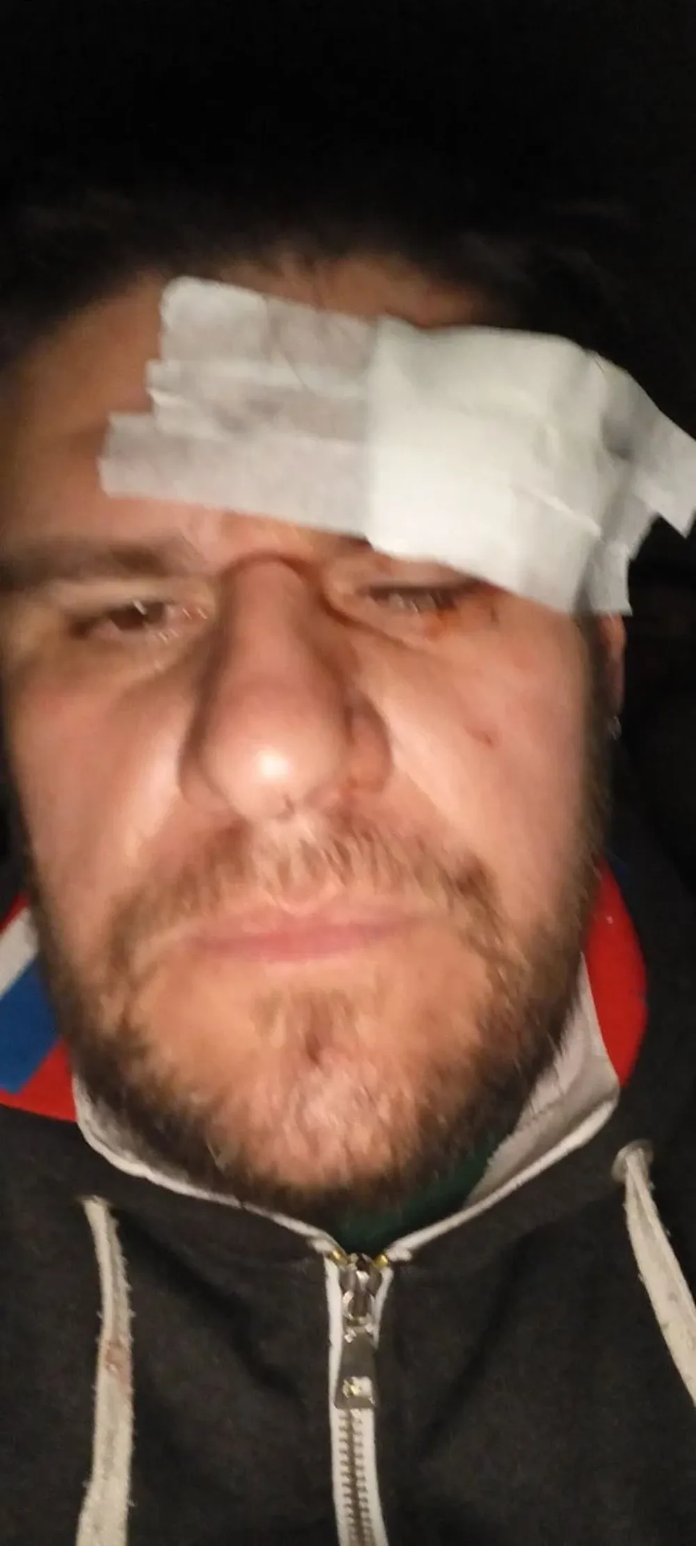 El corte que sufrió Paolo Benavente por las agresiones en Santa Fe