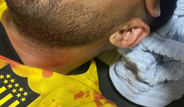 Tras la agresión, Maxi Olivera volvió con puntos de sutura al hotel y dejó un duro mensaje a Rosario Central