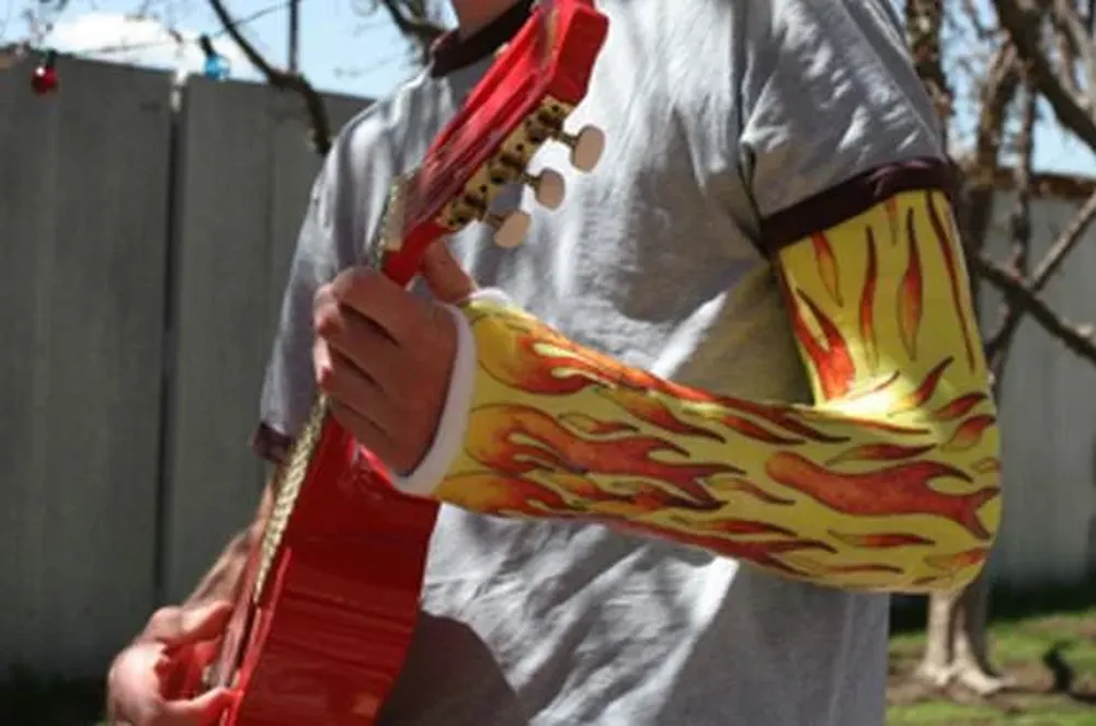 Desde tribales hasta fotos de placas que muestran huesos rotos, hasta flores y rayas son algunos de los diseños disponibles en Casttoo