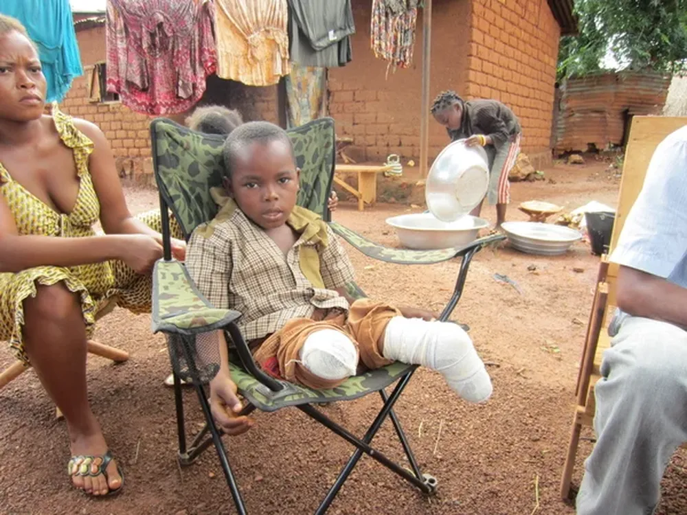 A Jovachi Mongonou, de nueve años, tuvieron que amputarle las piernas tras un ataque de Saleka