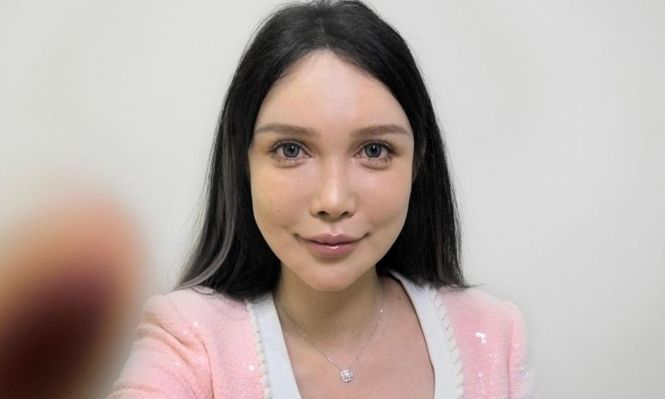 Abby Wu, que se ha sometido a más de 100 operaciones, es una de las primeras influencers chinas en temas de cirugía estética.