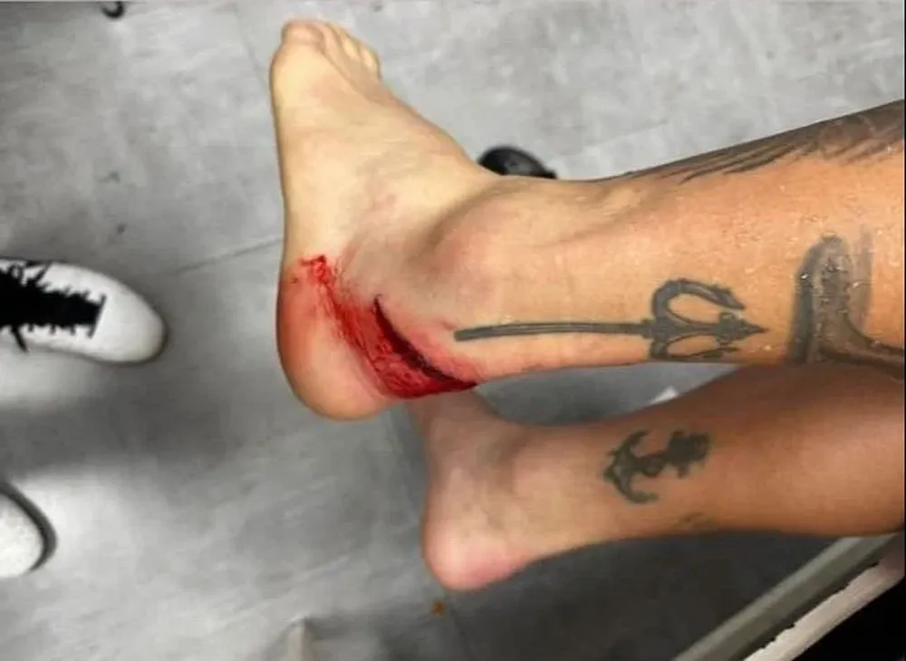 El tobillo de Bareiro