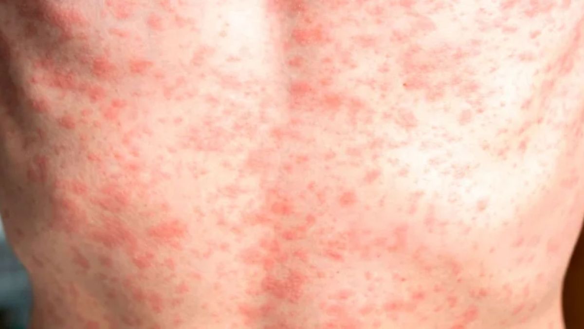 Imagen noticia completa