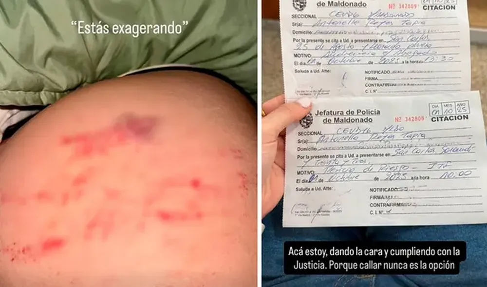 Las imágenes que subió Antonella Reyes, quien denuncia a Pablo Ceppelini Las imágenes que subió Antonella Reyes, quien denuncia a Pablo Ceppelini